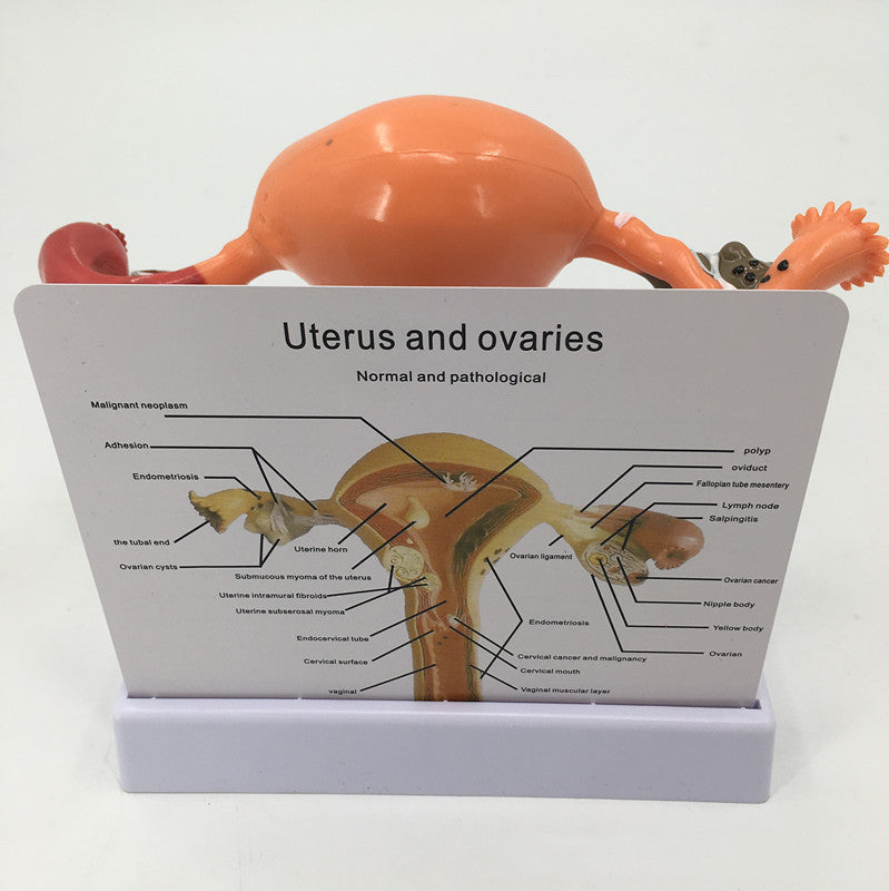 Female Pathological Uterus Model Female Maternal Uterus Structure Anatomy