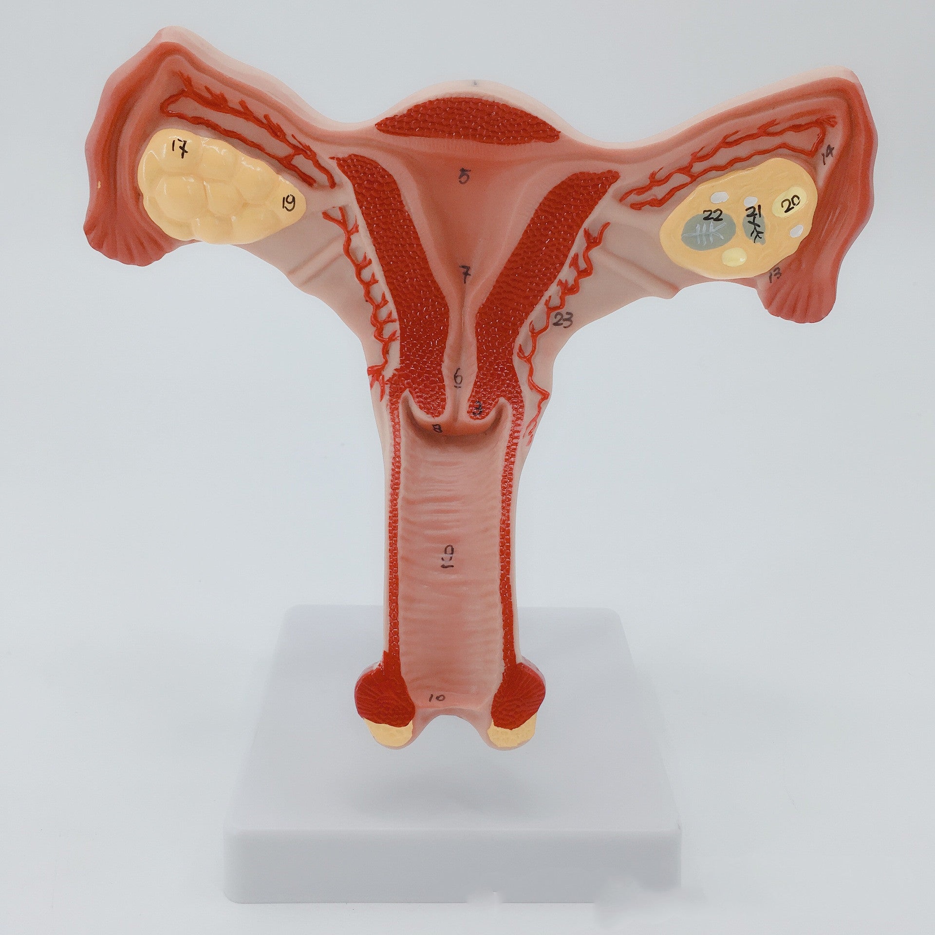 Female Pathological Uterus Model Female Maternal Uterus Structure Anatomy