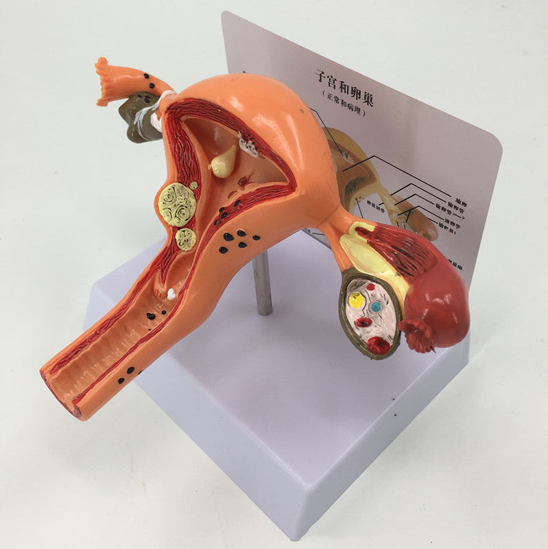 Female Pathological Uterus Model Female Maternal Uterus Structure Anatomy